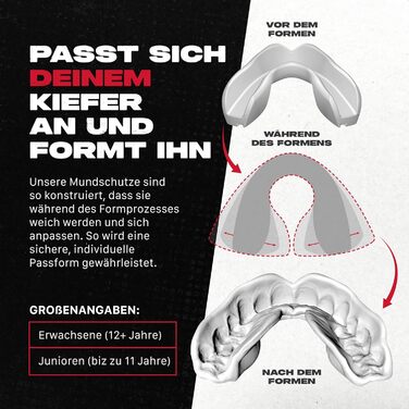 Капа спортивна SAFEJAWZ для захисту зубів з брекетами, прозора, універсальний розмір. Для контактних видів спорту: регбі, MMA, бокс, хокей, дзюдо, кікбоксинг, єдиноборства.