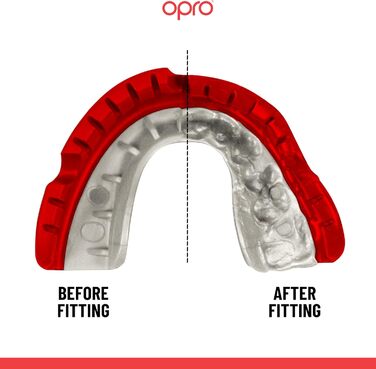 Захисна капа OPRO Gold для брекетів, спортивна, для дорослих, з інноваційною технологією підгонки, для боксу, ММА, хокею, лакросу та контактних видів спорту, червоно-перламутрова