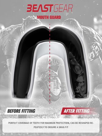 Захисна капа Beast Gear - для боксу, MMA, регбі, кікбоксингу, джудо, карате, хокею та бойових мистецтв. Зручна коробка для зберігання. Захищає зуби, ясна та щелепу. Білий.